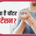 “वॉटर रिटेंशन “, कारण, लक्षण और बचाव-(डायटीशियन अमृता कुमारी)