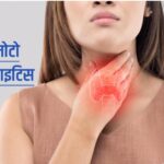 हाशिमोटो का थायरॉयडिटिस लक्षण, कारण और उपचार! (डायटीशियन अमृता)