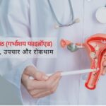 फाइब्रॉइड के कारण, लक्षण और इलाज।