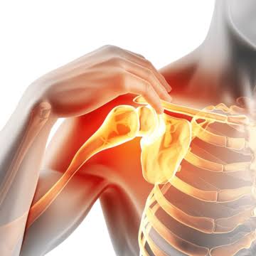 फ्रोजन शोल्डर: रिस्क फैक्टर और संकेत