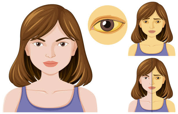 जॉन्डिस के मरीज़ों को कौन सी खाने की चीज़ें खानी चाहिए?