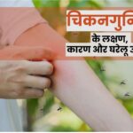 चिकनगुनिया के कारण, लक्षण, और सुरक्षा के उपाय।(डायटीशियन अमृता)