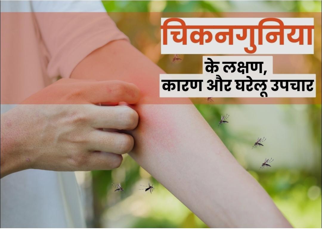 चिकनगुनिया के कारण, लक्षण, और सुरक्षा के उपाय।(डायटीशियन अमृता)