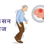 “विश्व पार्किंसंस दिवस” पर विशेष जानकारी और सलाह! (डायटीशियन अमृता)