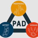 “पेरिफेरल आर्टरी डिजीज”, इस जानलेवा बीमारी के कारण, लक्षण और बचाव!