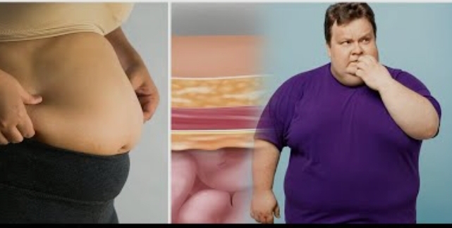 महिलाओं और पुरुषों में अलग अलग कारणों से होता है टमी फैट! (डायटीशियन अमृता)