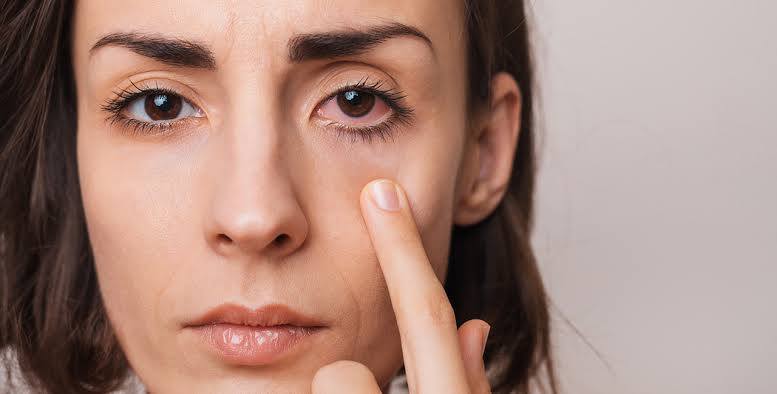 आँखों के सूखेपन के इलाज के लिए 5 फ़ूड्स