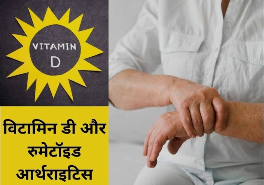 रूमेटाइड अर्थराइटिस के लक्षणों को गंभीर बना सकती है, विटामिन डी की कमी!