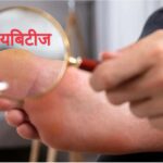 डायबिटीज में बेहद जरुरी है पैरों की देखभाल!