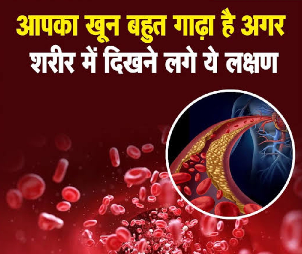 शरीर देता है संकेत, आपका खून हो रहा है गाढ़ा!